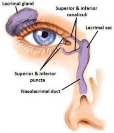 Tear Duct Surgery - Ophthalmic Consultants of Vermont